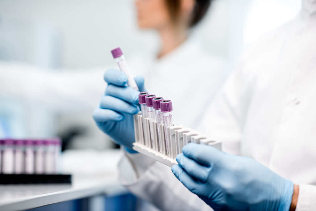 Doctor holding samples for lab tests